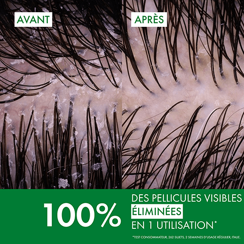100% DES PELLICULES VISIBLES ÉLIMINÉES EN 1 UTILISATION*