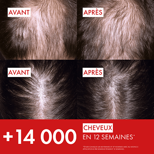 +14.000 CHEVEUX EN 12 SEMAINES*