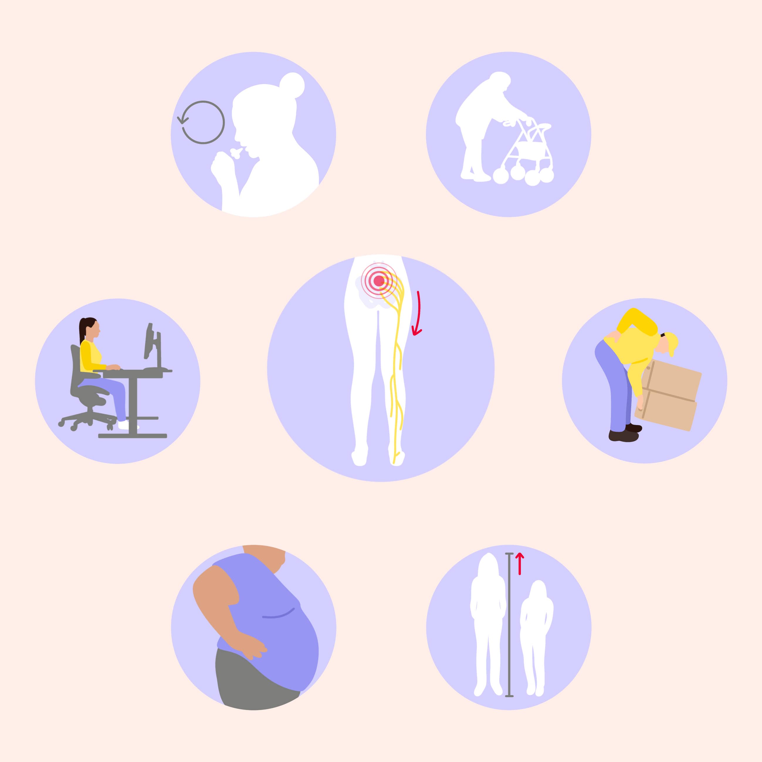 lomboischialgie causes