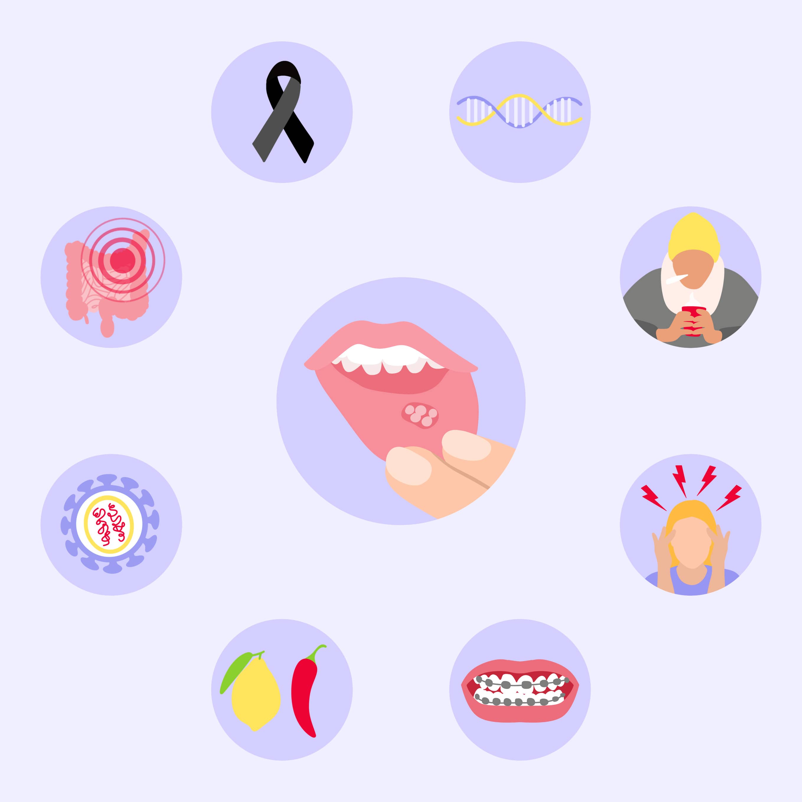 Causes des aphtes