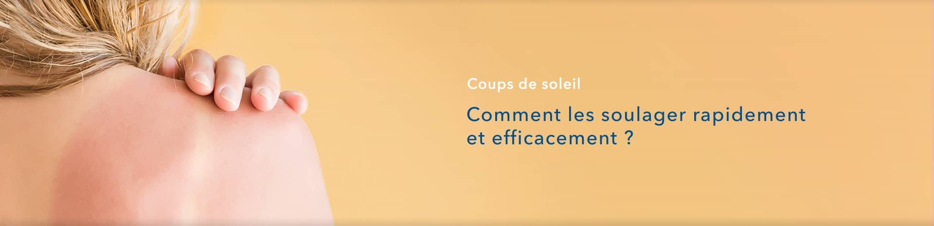 Coups de soleil : comment les soulager efficacement ? | Redcare Pharmacie