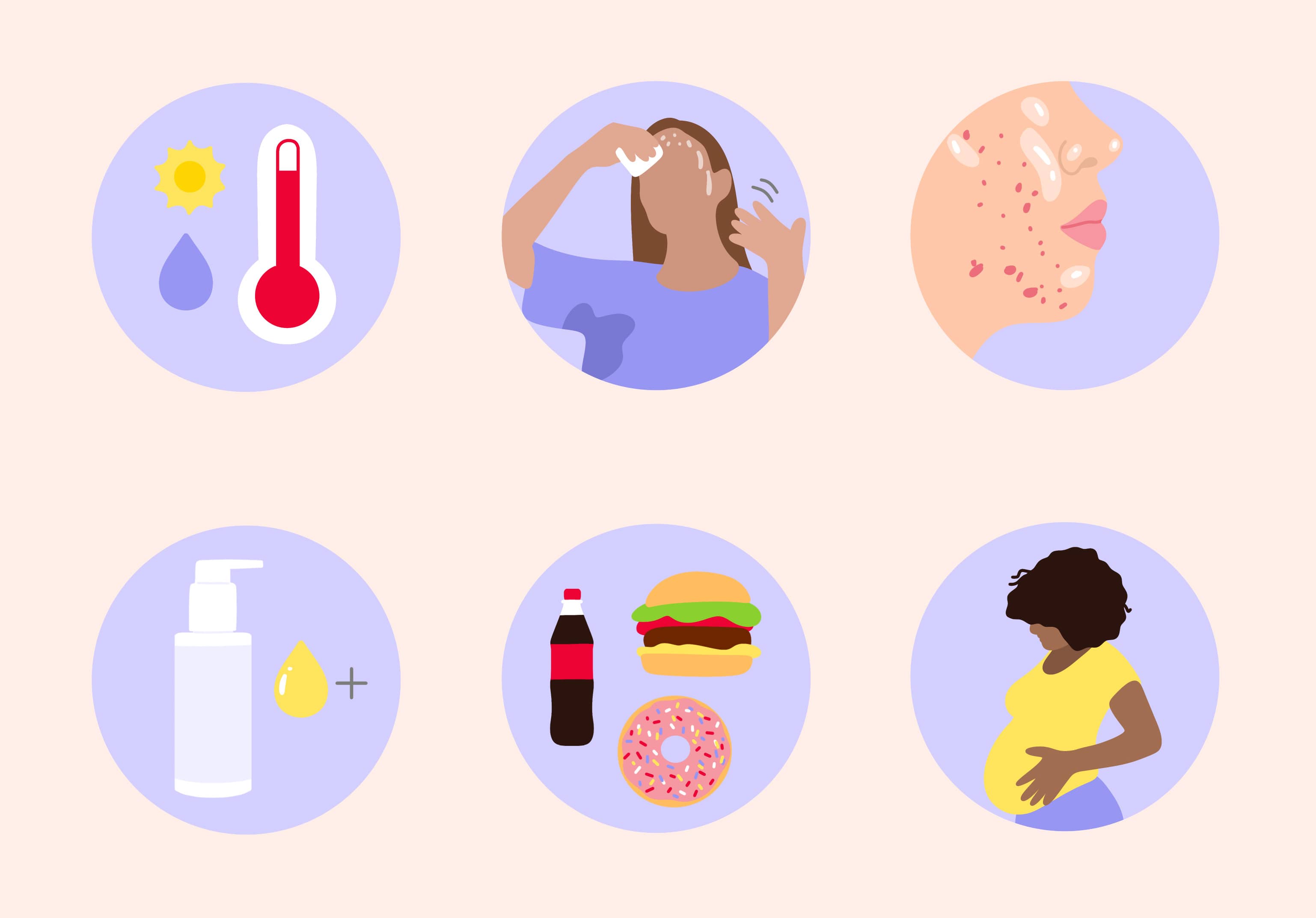 pityriasis versicolor cause