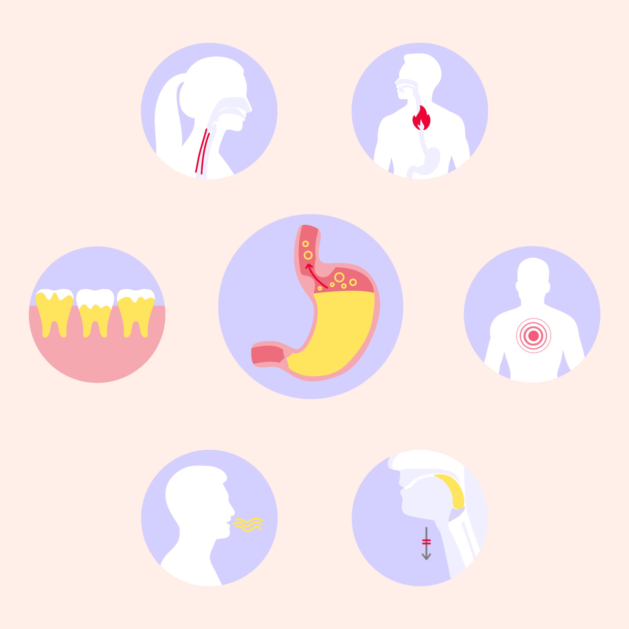 Reflux gastro-œsophagien symptomes